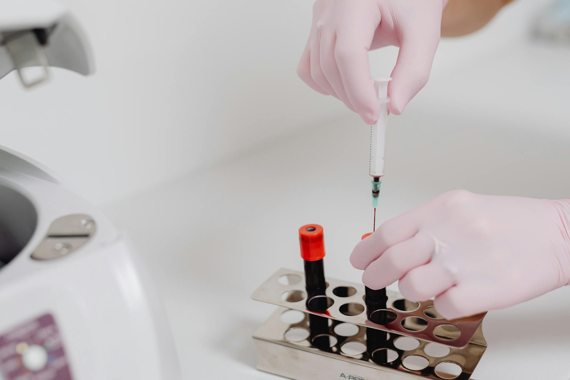 The Ultimate Guide to Understanding Your Blood Work Results